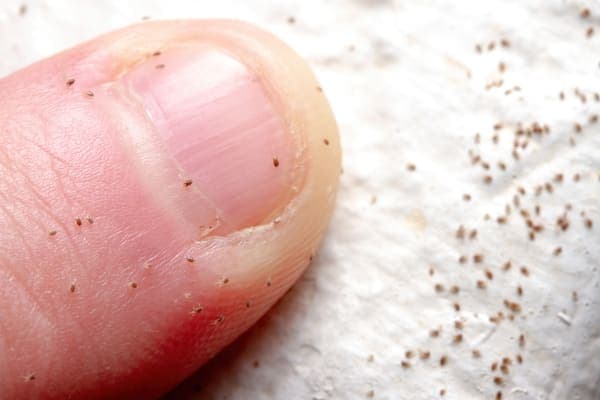 Mites